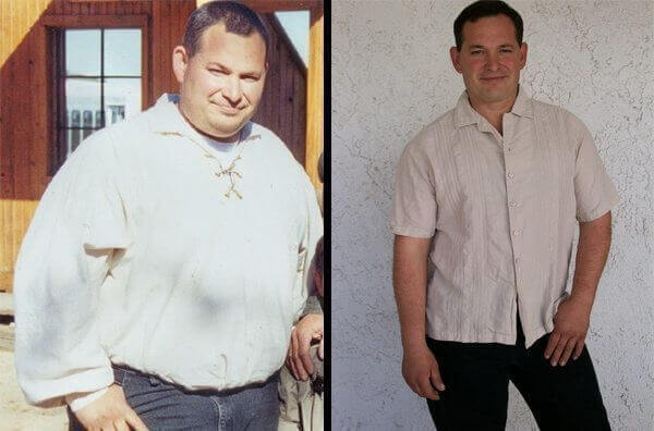 gastric bypass before and after man 2