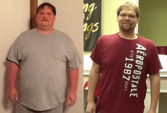 gastric bypass before and after man 5