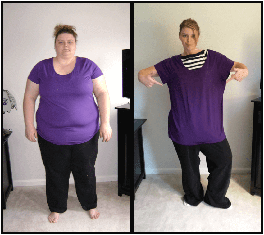 Gastric Bypass Before and After women 1