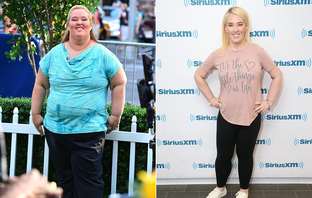 Gastric Sleeve Before and After Pictures and What You Can Expect