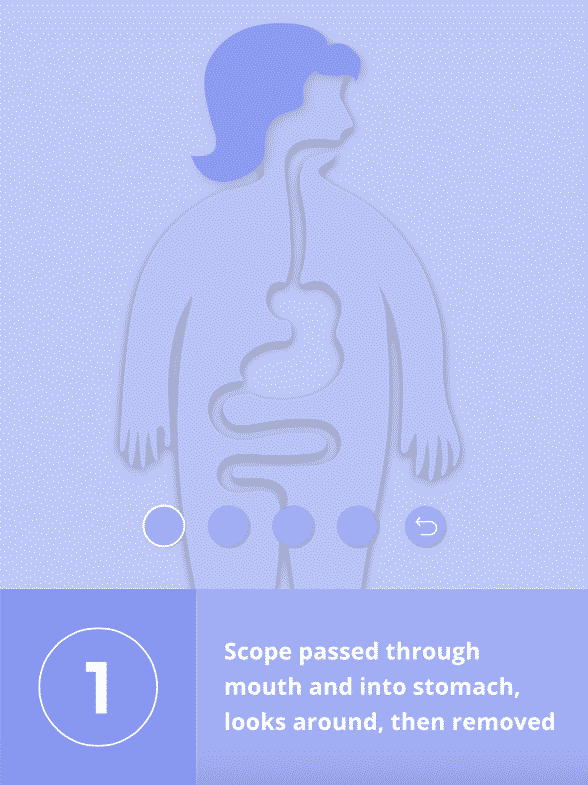 Gastric Balloon Bariatric Surgery Source