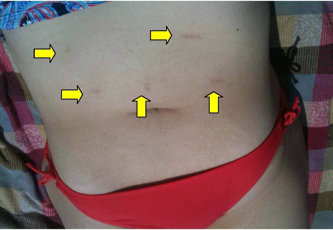 beach belly pic arrows