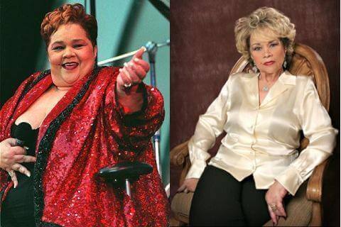 etta james weight loss surgery