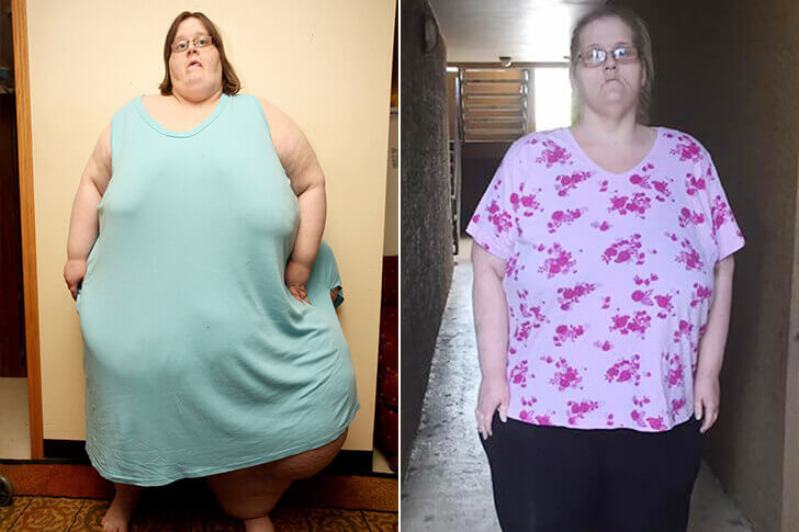 Gastric Bypass Before and After women 3