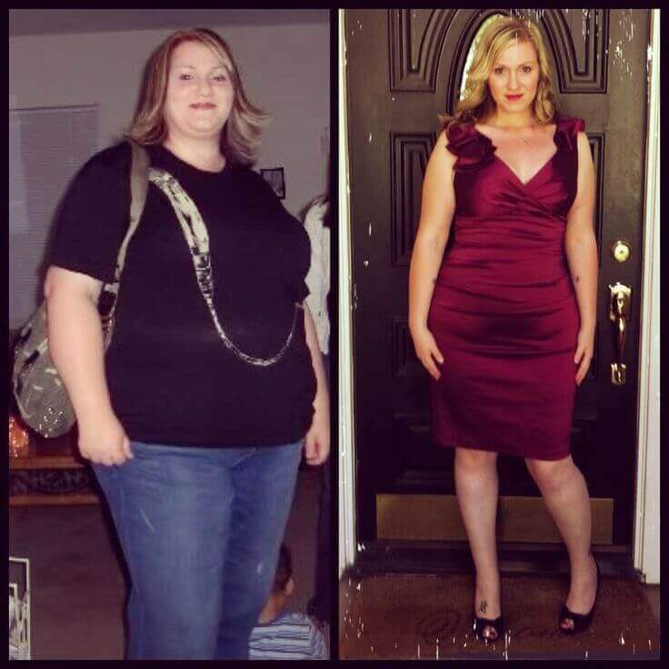 Gastric Bypass Before And After Pictures How Life Will Change gastric-bypass-before-and-after-pictures-how-life-will-change