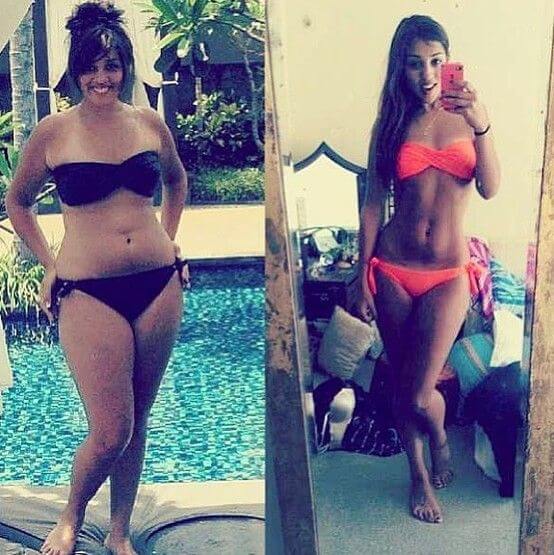 Gastric Balloon Reviews