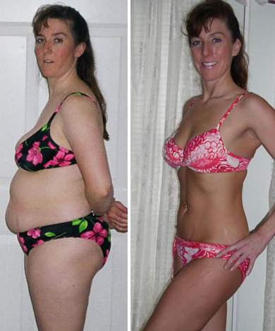 Gastric Balloon Reviews