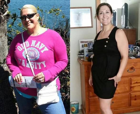 Gastric Balloon Reviews