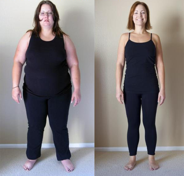Weight Loss Surgery Philadelphia.