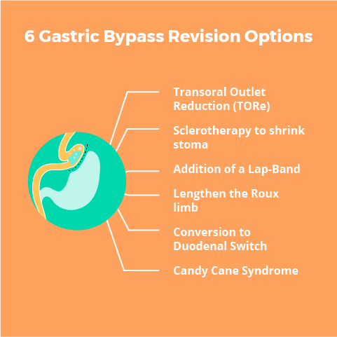 Gastric Bypass Revision