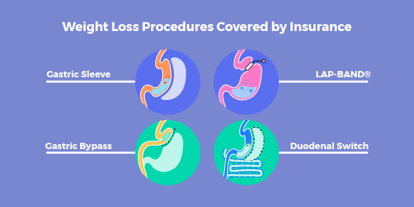 CareFirst Blue Cross Blue Shield Weight Loss Surgery