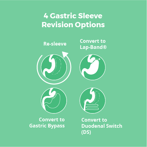 Gastric Sleeve Revision Surgery