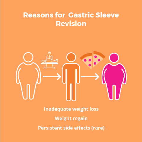 Gastric Sleeve Revision Surgery