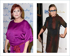 Gastric Sleeve Before after Women Celebrity 1