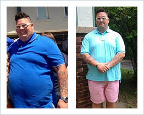Gastric Sleeve Before after Men Celebrity 2