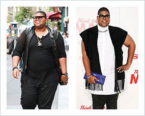 Gastric Sleeve Before after Men Celebrity 3