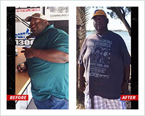 Gastric Sleeve Before after Men Celebrity 5