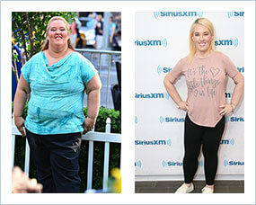 Gastric Sleeve Before after Women Celebrity 3