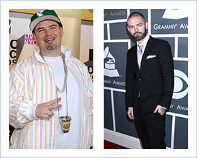 Gastric Sleeve Before after Men Celebrity 1