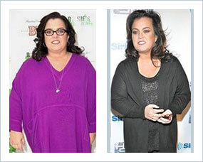 Gastric Sleeve Before after Women Celebrity 2