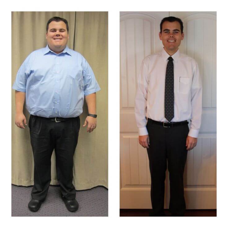 Gastric Sleeve Before after Men 3