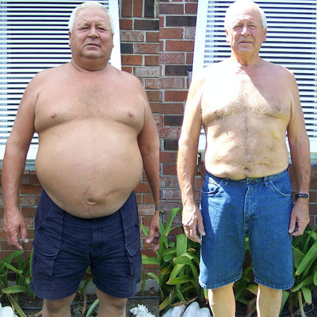 Gastric Sleeve Before after Men 4