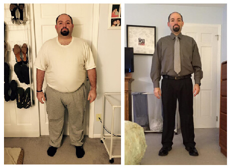 Gastric Sleeve Before after Men 5