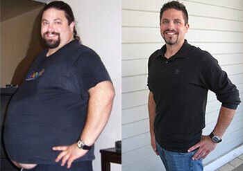 Gastric Sleeve Before after Men 6