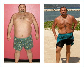 Gastric Sleeve Before after Men 1