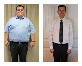 Gastric Sleeve Before after Men 3