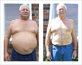 Gastric Sleeve Before after Men 4