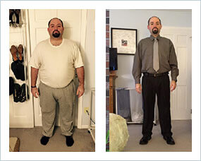 Gastric Sleeve Before after Men 5
