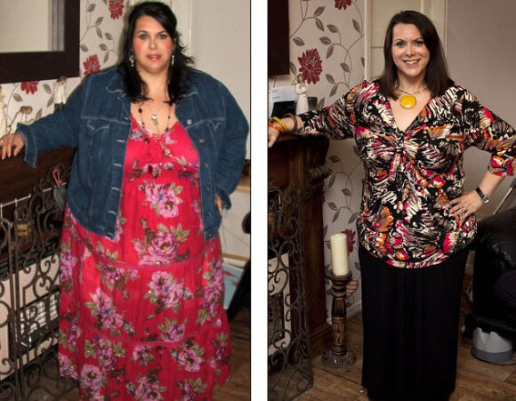 Gastric Sleeve Before after Women 3