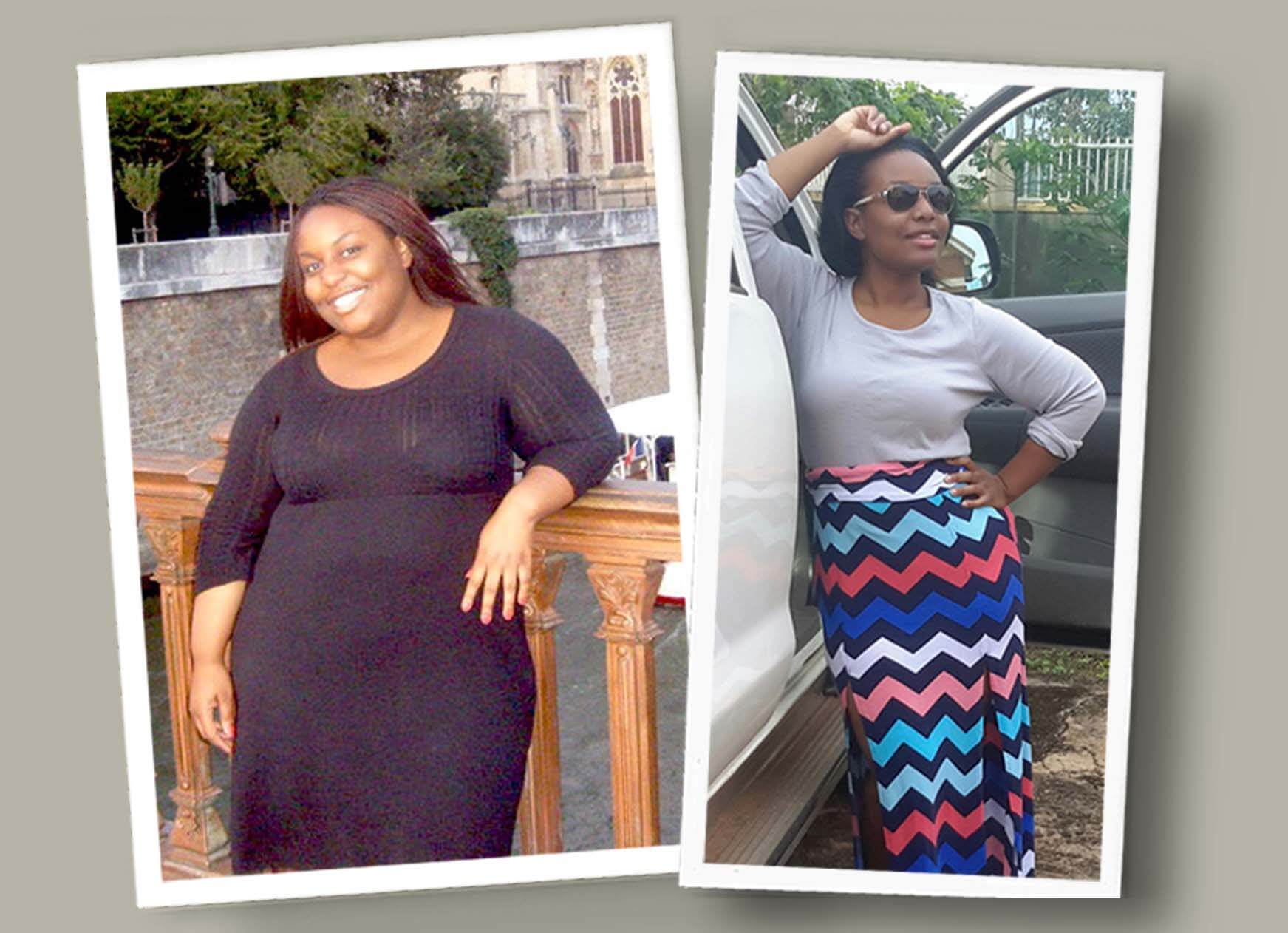 Gastric Sleeve Before after Women 7