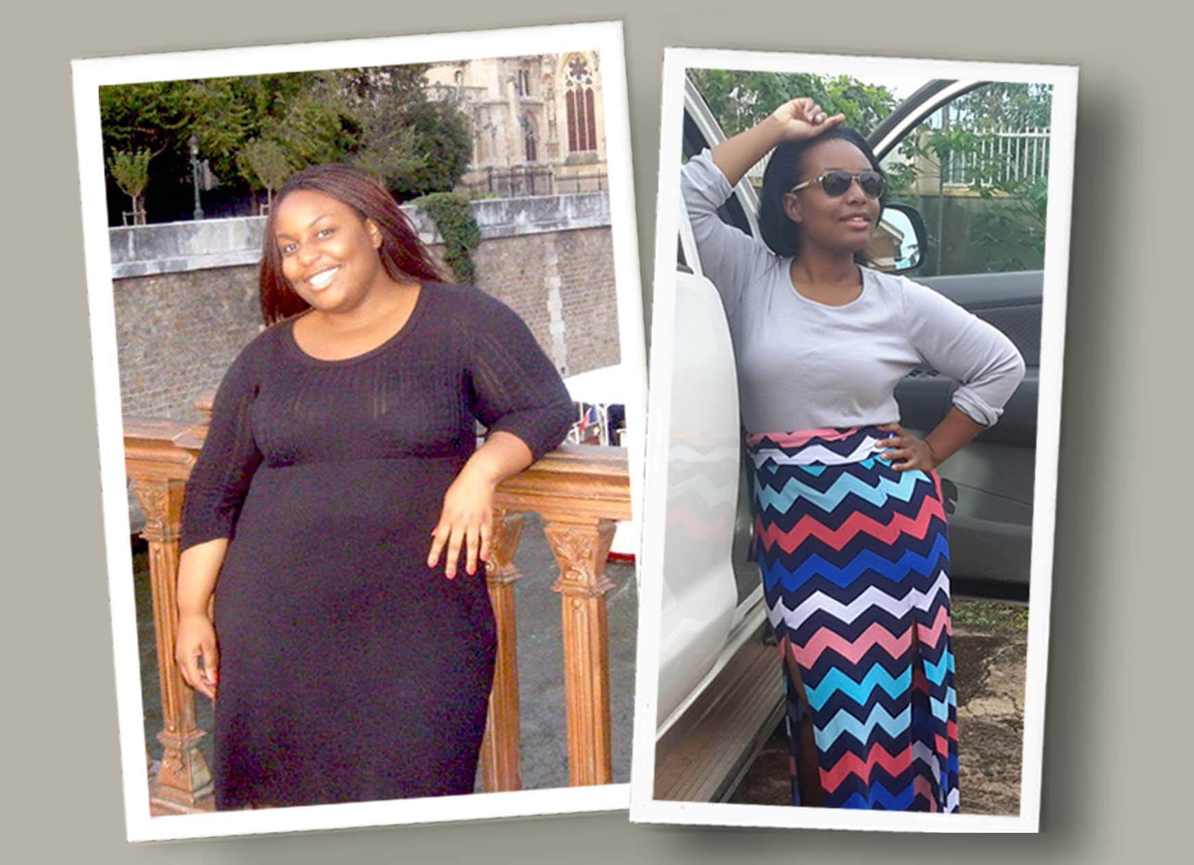 gastric bypass before and after black women