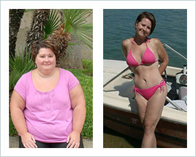 https://www.bariatric-surgery-source.com/image-files/sleeve_before_after_images/sleeve_before_after_women_1.jpg