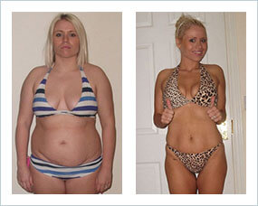 Gastric Sleeve Before after Women 4