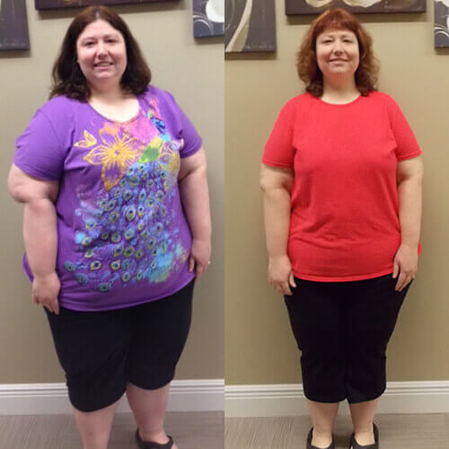 Gastric Sleeve Success Stories - Freedom From Obesity - Bariatric ...