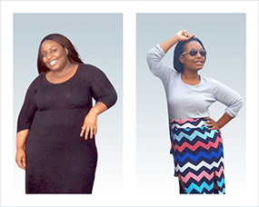 Gastric Sleeve Before after Women 7