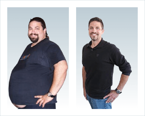 Gastric Sleeve Before after Men 6