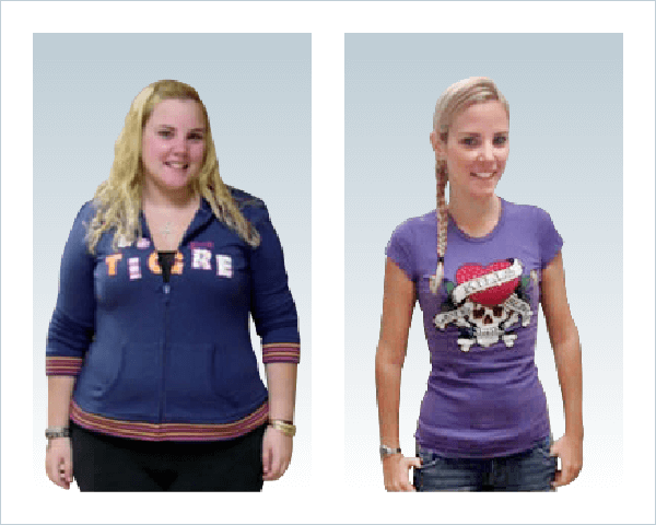 gastric sleeve journey before and after