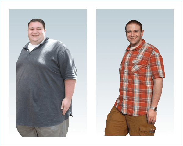 Gastric Sleeve Before after Men 2