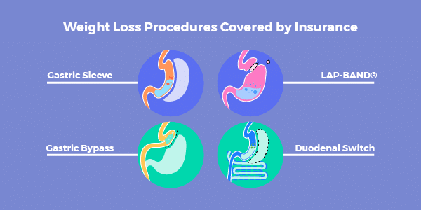 Weight Loss Surgery Insurance Secrets Revised List